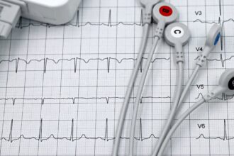 découvrez tout ce qu'il faut savoir sur les tests cardiovasculaires : leur importance pour la santé cardiaque, les différents types d'examens disponibles et comment ils peuvent aider à prévenir les maladies cardiovasculaires.