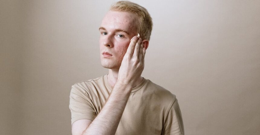 découvrez des solutions efficaces pour traiter l'acné et retrouver une peau saine et éclatante. nos conseils et produits adaptés vous aideront à combattre les imperfections et à améliorer la texture de votre peau.