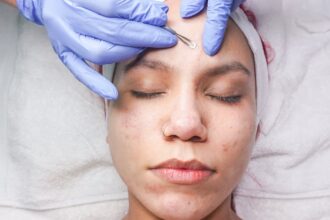 découvrez des traitements efficaces contre l'acné pour retrouver une peau saine et radieuse. que vous soyez à la recherche de solutions médicales, de conseils de soins ou de remèdes naturels, notre guide vous aide à éliminer les imperfections et à prévenir les récidives.