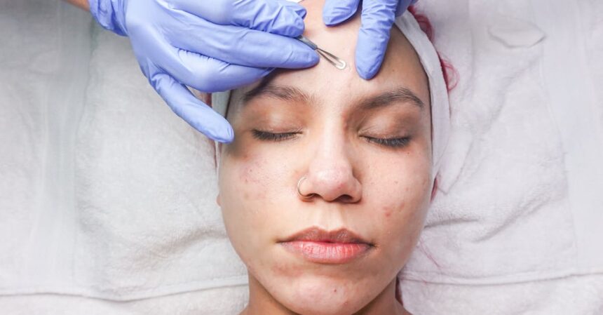 découvrez des traitements efficaces contre l'acné pour retrouver une peau saine et radieuse. que vous soyez à la recherche de solutions médicales, de conseils de soins ou de remèdes naturels, notre guide vous aide à éliminer les imperfections et à prévenir les récidives.