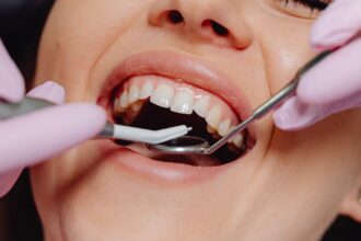 découvrez nos méthodes efficaces de traitement des poches gingivales pour améliorer votre santé bucco-dentaire. des solutions adaptées pour réduire l'inflammation et favoriser une meilleure hygiène dentaire.