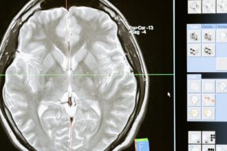 découvrez tout ce que vous devez savoir sur les tumeurs cérébrales : types, symptômes, diagnostics et traitements. informez-vous sur les avancées scientifiques et les options de prise en charge pour mieux comprendre cette maladie complexe.