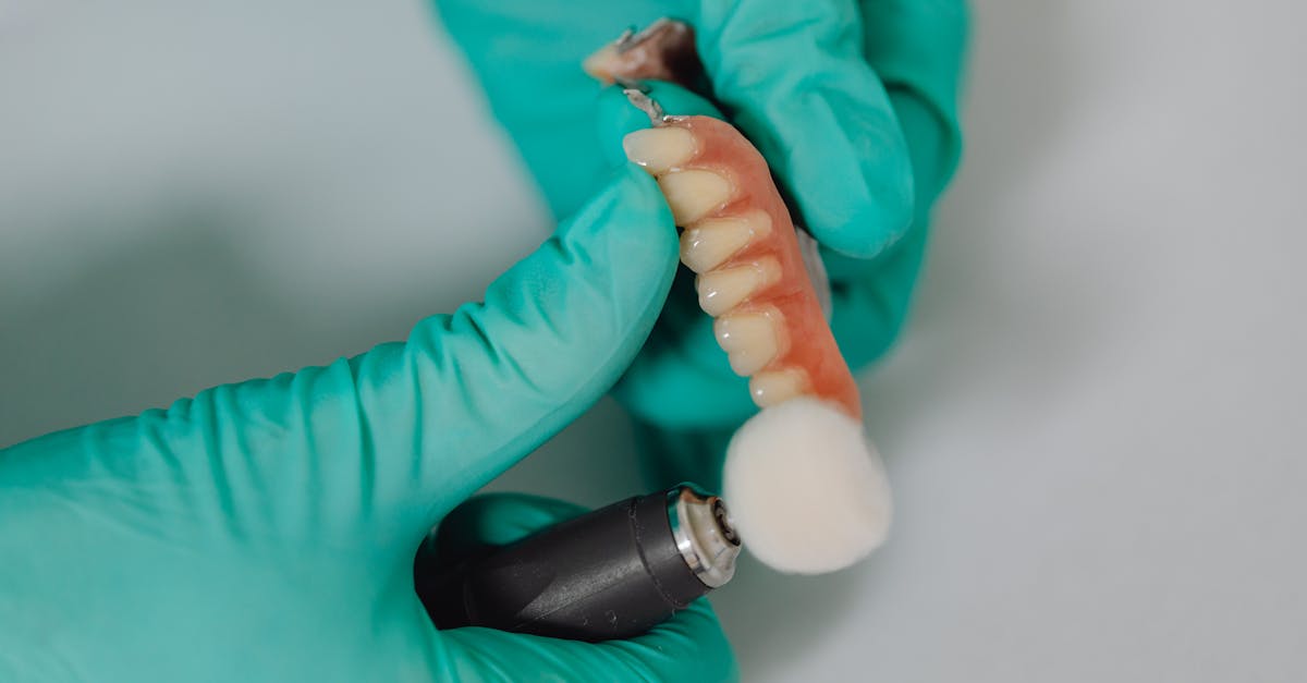 découvrez tout ce que vous devez savoir sur les infections liées aux implants dentaires, leurs causes, symptômes et options de traitement pour préserver votre santé bucco-dentaire.