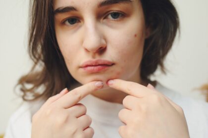 découvrez des traitements efficaces contre l'acné pour retrouver une peau saine et éclatante. explorez nos conseils, astuces et produits adaptés pour lutter contre les imperfections et améliorer votre teint.