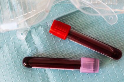 découvrez le monde des anticorps : des protéines essentielles du système immunitaire qui neutralisent les agents pathogènes. apprenez leur rôle, leur fonctionnement et leur importance dans la protection de l'organisme contre les maladies.
