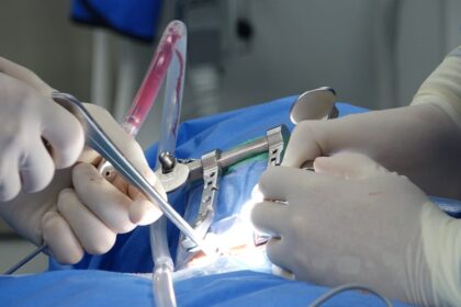 découvrez les risques associés à la chirurgie du dos, y compris les complications potentielles, le processus de récupération et les précautions à prendre pour assurer votre sécurité. informez-vous sur les différents types de procédures et leurs impacts sur votre santé.