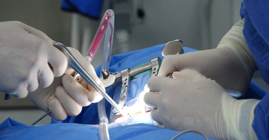 découvrez les risques associés à la chirurgie du dos, y compris les complications potentielles, le processus de récupération et les précautions à prendre pour assurer votre sécurité. informez-vous sur les différents types de procédures et leurs impacts sur votre santé.