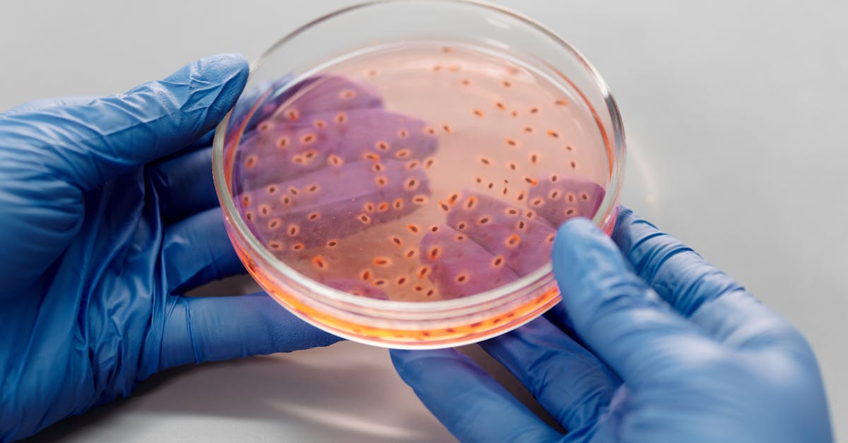 découvrez tout ce qu'il faut savoir sur les infections bactériennes : causes, symptômes, traitements et mesures préventives pour protéger votre santé.
