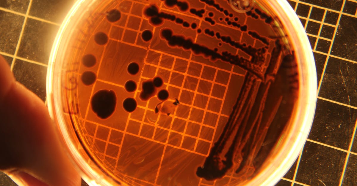 découvrez tout ce qu'il faut savoir sur les infections bactériennes : causes, symptômes, traitements et préventions pour protéger votre santé.