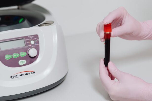 découvrez l'importance de l'analyse sanguine pour votre santé. explorez les différents types de tests, leur fonctionnement, et comment ils peuvent aider à diagnostiquer et surveiller diverses conditions médicales.