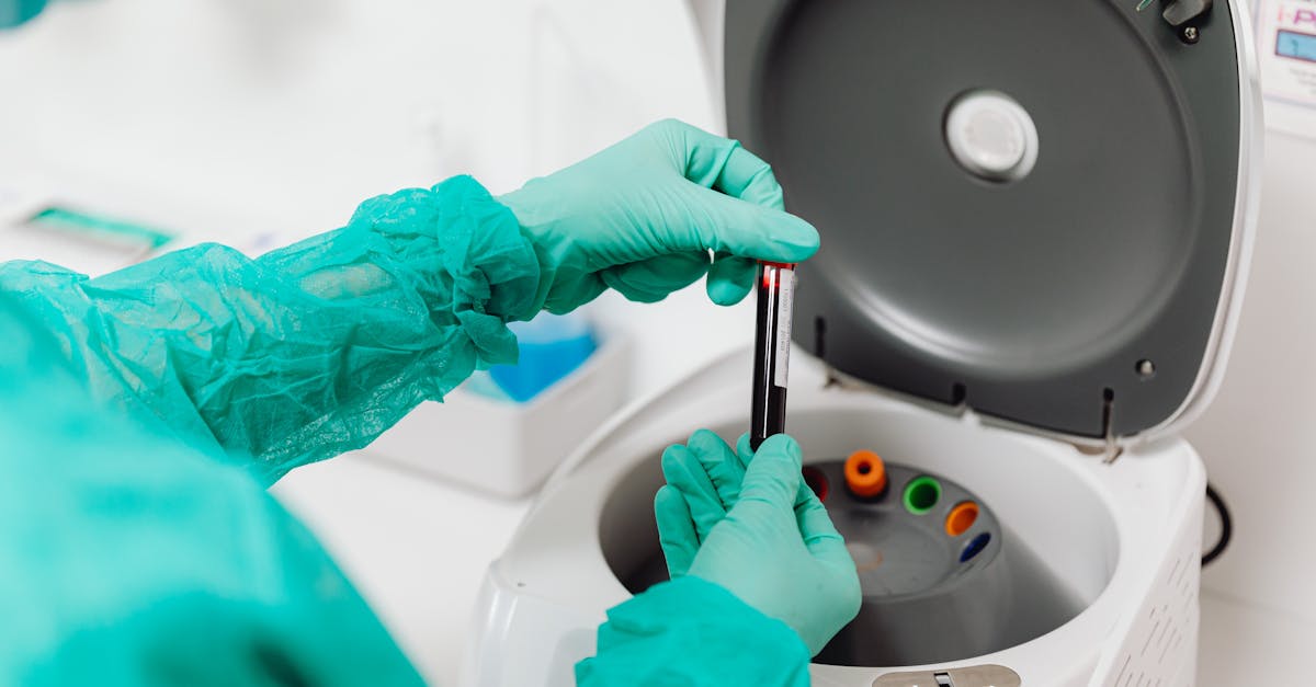 découvrez l'importance des analyses de sang pour votre santé. apprenez comment les tests sanguins peuvent détecter des maladies, évaluer votre bien-être général et guider les décisions médicales. informez-vous sur les différents types de tests, leur processus et leur impact sur votre suivi médical.