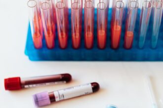 découvrez l'importance des tests de sang pour surveiller votre santé. apprenez-en plus sur les différents types d'analyses sanguines, leur déroulement, et comment elles peuvent détecter d'éventuelles maladies. prenez soin de vous grâce à un suivi médical régulier.