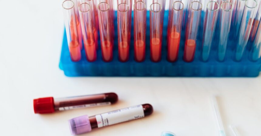 découvrez l'importance des tests de sang pour surveiller votre santé. apprenez-en plus sur les différents types d'analyses sanguines, leur déroulement, et comment elles peuvent détecter d'éventuelles maladies. prenez soin de vous grâce à un suivi médical régulier.