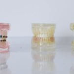 découvrez les avantages des implants dentaires pour restaurer votre sourire. nos solutions de pointe assurent confort et durabilité, adaptées à chaque besoin. prenez rendez-vous dès aujourd'hui pour retrouver une bouche en pleine santé !