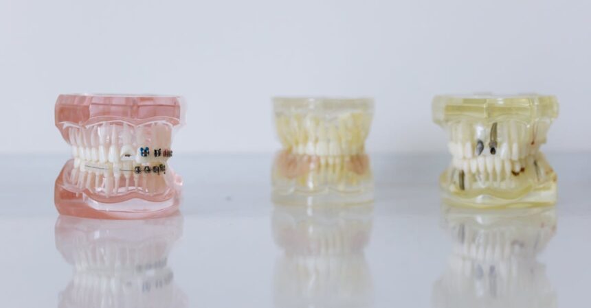 découvrez les avantages des implants dentaires pour restaurer votre sourire. nos solutions de pointe assurent confort et durabilité, adaptées à chaque besoin. prenez rendez-vous dès aujourd'hui pour retrouver une bouche en pleine santé !