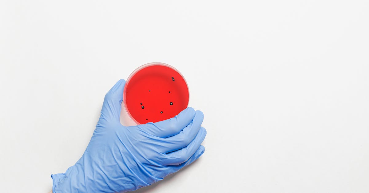 découvrez les stratégies et conseils essentiels pour la prévention des maladies. apprenez à adopter un mode de vie sain, à vous informer sur les vaccinations et à réduire les risques pour votre santé. assurez votre bien-être et celui de vos proches grâce à des actions préventives efficaces.