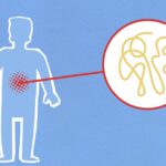 découvrez tout sur l'inflammation : ses causes, ses symptômes et les meilleures stratégies pour la gérer. informez-vous sur les traitements naturels et médicaux pour soulager vos douleurs et améliorer votre bien-être.