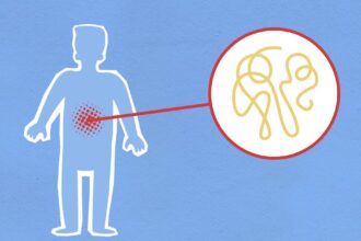 découvrez tout sur l'inflammation : ses causes, ses symptômes et les meilleures stratégies pour la gérer. informez-vous sur les traitements naturels et médicaux pour soulager vos douleurs et améliorer votre bien-être.