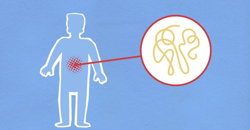 découvrez tout sur l'inflammation : ses causes, ses symptômes et les meilleures stratégies pour la gérer. informez-vous sur les traitements naturels et médicaux pour soulager vos douleurs et améliorer votre bien-être.