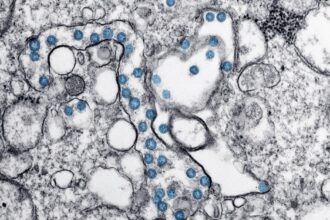 découvrez le monde fascinant du microbiome, cet ensemble de micro-organismes vivant en symbiose dans notre corps. apprenez comment il influence notre santé, notre digestion et même notre humeur. explorez les dernières recherches et astuces pour optimiser votre microbiome et améliorer votre bien-être.