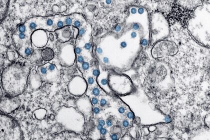 découvrez le monde fascinant du microbiome, cet ensemble de micro-organismes vivant en symbiose dans notre corps. apprenez comment il influence notre santé, notre digestion et même notre humeur. explorez les dernières recherches et astuces pour optimiser votre microbiome et améliorer votre bien-être.