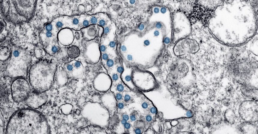 découvrez le monde fascinant du microbiome, cet ensemble de micro-organismes vivant en symbiose dans notre corps. apprenez comment il influence notre santé, notre digestion et même notre humeur. explorez les dernières recherches et astuces pour optimiser votre microbiome et améliorer votre bien-être.