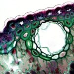 découvrez le rôle essentiel des muqueuses dans le corps humain, leur structure, leurs fonctions et leur importance pour la santé globale. apprenez comment ces membranes protègent les organes et participent à divers processus physiologiques.