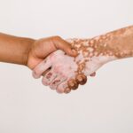 découvrez tout ce qu'il faut savoir sur le psoriasis : causes, symptômes, traitements et conseils pour mieux vivre avec cette maladie de la peau. informez-vous pour mieux comprendre et gérer votre santé.