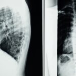 découvrez le monde de la radiologie, une discipline médicale essentielle qui utilise des images diagnostiques pour détecter et traiter diverses conditions de santé. apprenez-en plus sur les technologies avancées comme l'irm et le scanner, et leur rôle crucial dans le diagnostic médical.