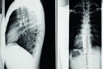 découvrez le monde de la radiologie, une discipline médicale essentielle qui utilise des images diagnostiques pour détecter et traiter diverses conditions de santé. apprenez-en plus sur les technologies avancées comme l'irm et le scanner, et leur rôle crucial dans le diagnostic médical.