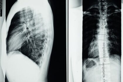 découvrez le monde de la radiologie, une discipline médicale essentielle qui utilise des images diagnostiques pour détecter et traiter diverses conditions de santé. apprenez-en plus sur les technologies avancées comme l'irm et le scanner, et leur rôle crucial dans le diagnostic médical.