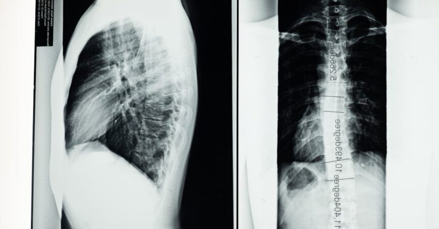 découvrez le monde de la radiologie, une discipline médicale essentielle qui utilise des images diagnostiques pour détecter et traiter diverses conditions de santé. apprenez-en plus sur les technologies avancées comme l'irm et le scanner, et leur rôle crucial dans le diagnostic médical.