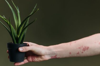 découvrez tout sur les éruptions cutanées (rash) : causes, symptômes, traitements et conseils pour apaiser votre peau. informez-vous sur les différents types de rash et comment prévenir leur apparition.