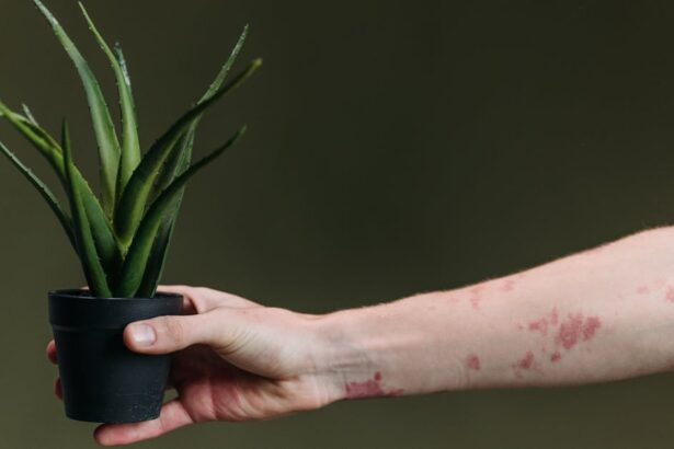 découvrez tout sur les éruptions cutanées (rash) : causes, symptômes, traitements et conseils pour apaiser votre peau. informez-vous sur les différents types de rash et comment prévenir leur apparition.