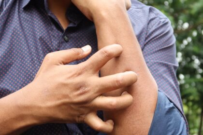 découvrez les causes et les solutions pour apaiser les irritations cutanées. informez-vous sur les symptômes, les traitements et les conseils pour protéger votre peau.