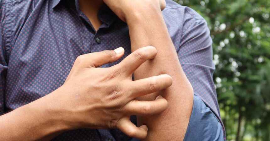 découvrez les causes et les solutions pour apaiser les irritations cutanées. informez-vous sur les symptômes, les traitements et les conseils pour protéger votre peau.