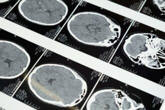 découvrez les symptômes courants associés à diverses conditions de santé. apprenez à les identifier et à prendre des mesures préventives pour votre bien-être.