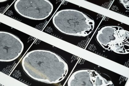 découvrez les symptômes courants associés à diverses conditions de santé. apprenez à les identifier et à prendre des mesures préventives pour votre bien-être.