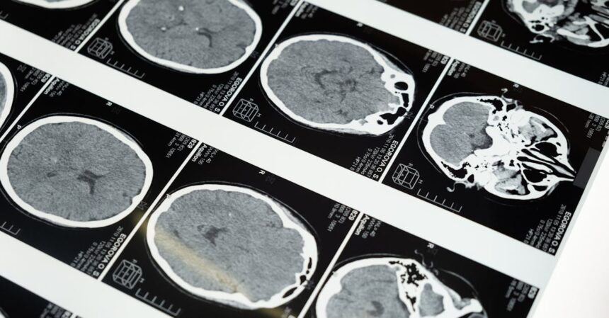 découvrez les symptômes courants associés à diverses conditions de santé. apprenez à les identifier et à prendre des mesures préventives pour votre bien-être.