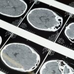 découvrez les symptômes courants de diverses conditions de santé. informez-vous sur les signes à surveiller pour mieux comprendre votre bien-être et celui de vos proches. obtenez des conseils pratiques pour savoir quand consulter un professionnel de santé.