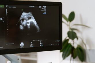 découvrez les multiples applications de l'échographie : un examen médical non invasif et essentiel pour le diagnostic, le suivi des grossesses et l'exploration des organes internes. informez-vous sur cette technique d'imagerie sûre et ses avantages.
