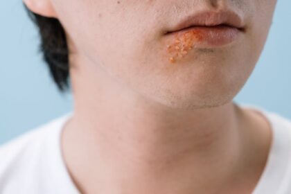 découvrez les symptômes des maladies virales les plus courantes. apprenez à reconnaître les signes de ces infections pour mieux les prévenir et les traiter. informez-vous sur les symptômes associés aux différents virus et restez en bonne santé.