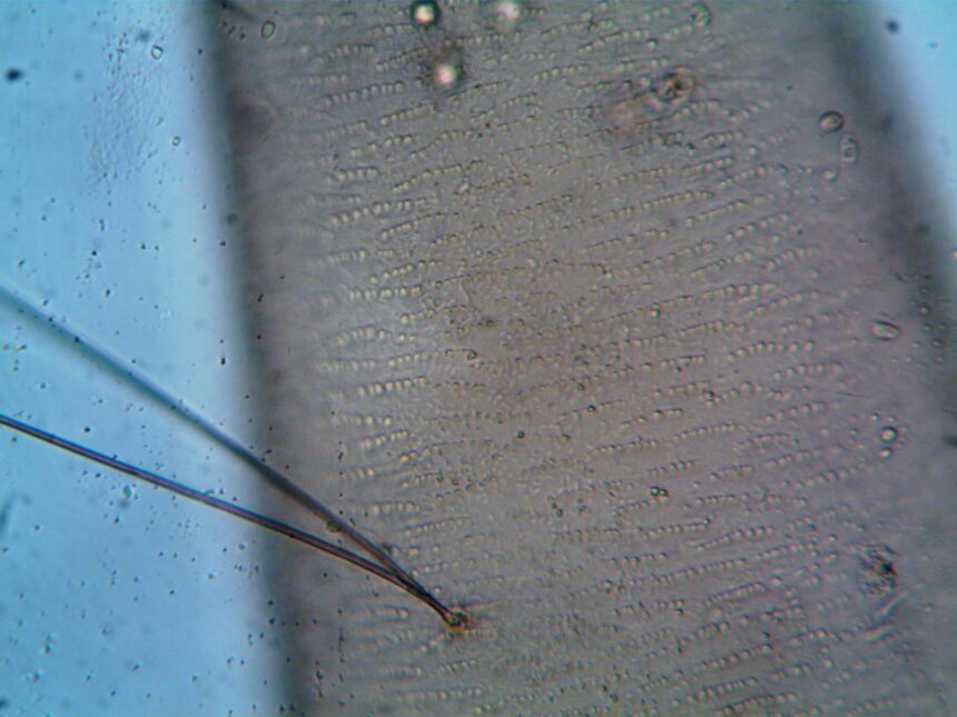 bactérie helicobacter pylori